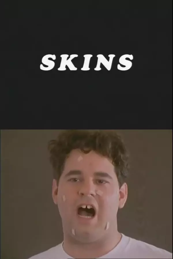 Skins